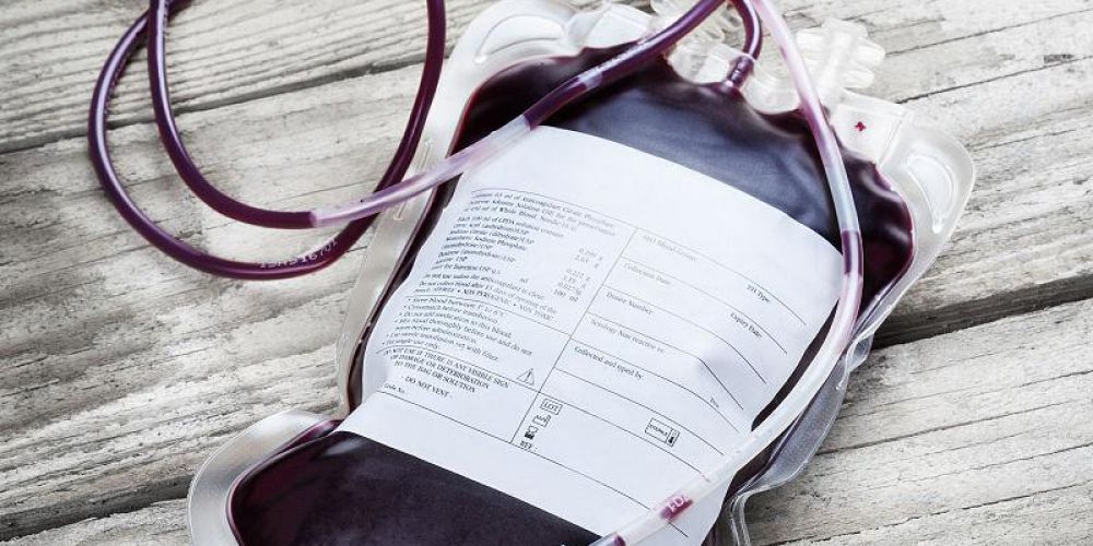 Analysis of High-Frequency Welding Technology for Blood Bags: A Key Process for Ensuring Sealing and Asepticity